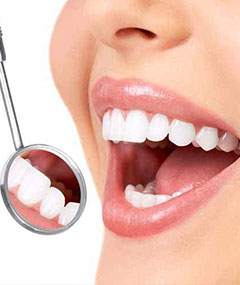 Diş Beyazlatma